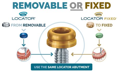 what is a locator metal housing|3 in 1 locator attachment.